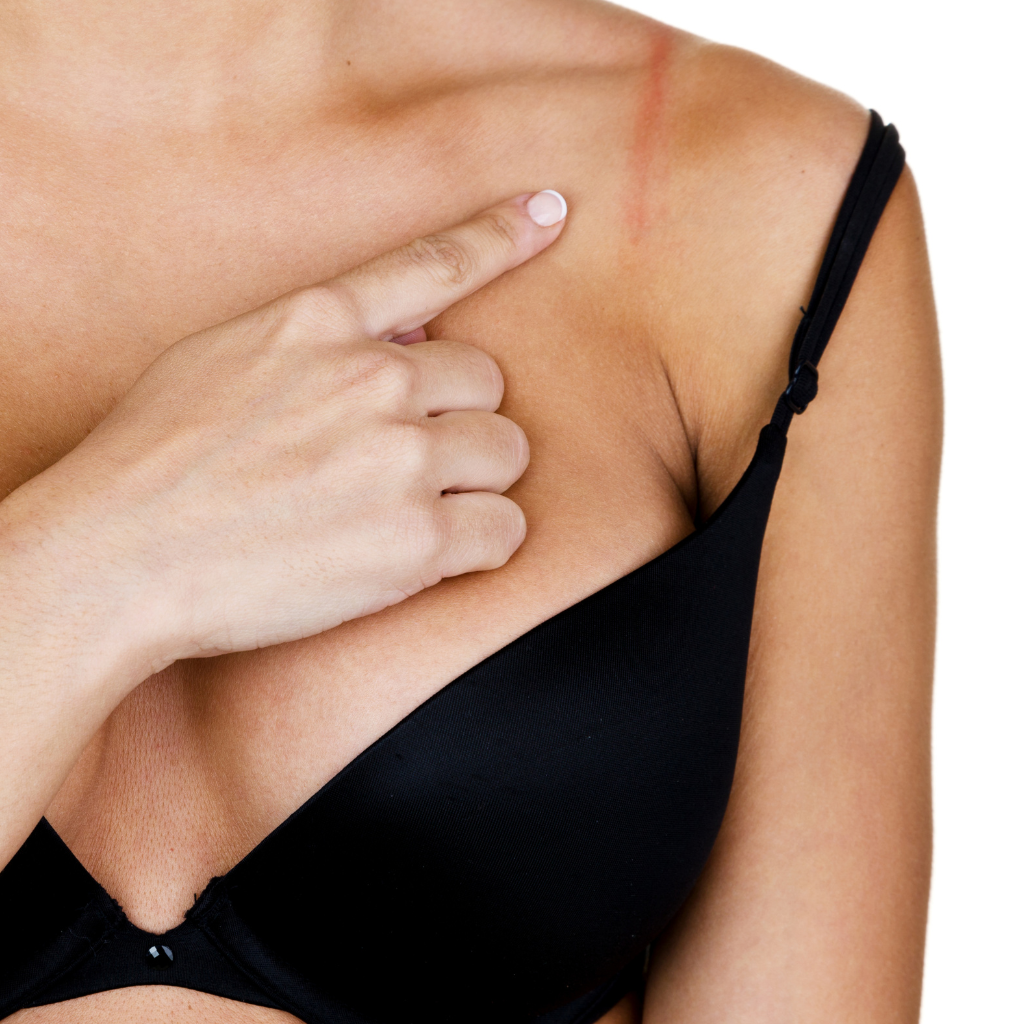 Bras and Red Marks: Myth Busters & Solutions for a Happy Bust – The Perky  Lady®