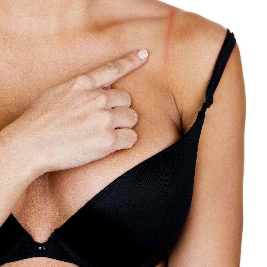 Bras and Red Marks: Myth Busters & Solutions for a Happy Bust